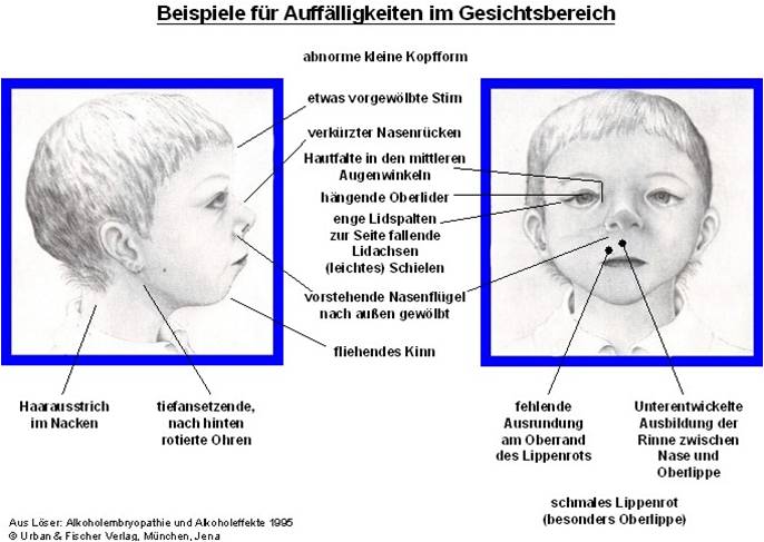 Bild3